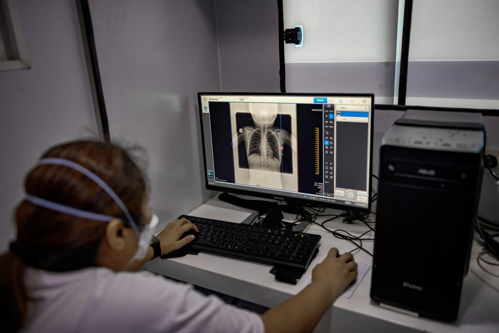 Uma trabalhadora da MSF realiza uma radiografia do tórax num dos locais de deteção ativa de casos de tuberculose da MSF em Tondo, Manila, nas Filipinas. 