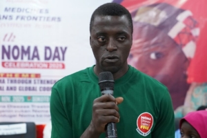 Hussaini Usman, sobrevivente da noma e agente de higiene da MSF, discursa durante as comemorações do 9.º Dia da Noma em Sokoto, Nigéria.