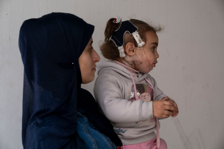Khadija, de 34 anos, segura a filha, Salam, de 2 anos, na clínica da MSF na cidade de Gaza. Salam usa uma máscara personalizada, impressa em 3D, para tratar queimaduras faciais graves que sofreu quando um ataque aéreo israelita abalou a tenda onde a família deslocada vivia e uma panela se entornou sobre o seu rosto.