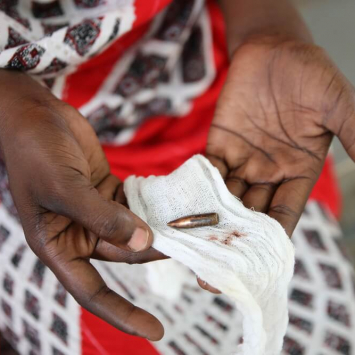 Depois de ser baleada no pescoço e ser atendida no hospital de Abéché, uma mulher sudanesa segura a bala que a atingiu, após esta ser retirada.
