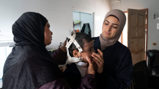 Próteses 3D para tratar queimados em Gaza