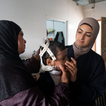 Próteses 3D para tratar queimados em Gaza