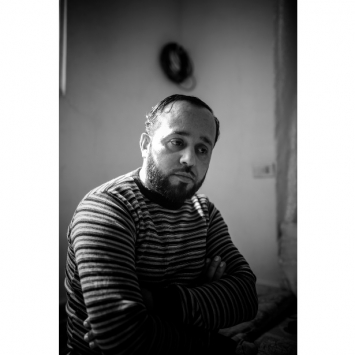 Meu nome é Omar Al Balkhu, tenho 29 anos, e sou sírio. Fui ferido na guerra, devido a um bombardeio em Daraa. Por sete dias, recebi tratamento na Síria, em um hospital onde faltam instrumentos cirúrgicos. Consequentemente, fui transferido, depois de um pedido do médico, para a Jordânia.