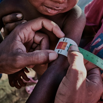 A desnutrição ameaça a população de algumas regiões de Madagascar