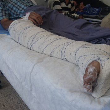 Hospital em Hassakeh recebe mais vítimas de ataques aéreos no norte da Síria